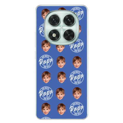 Xiaomi Redmi Note 14 Pro - Poco X7 source