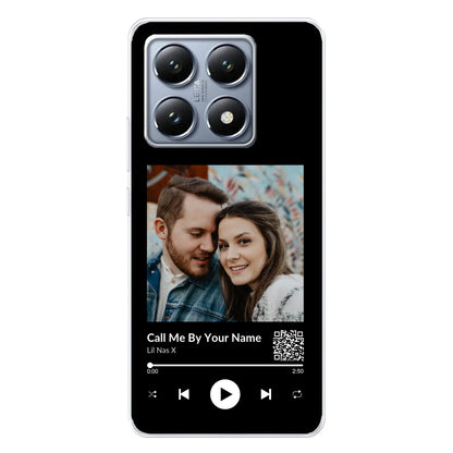 Xiaomi 14T source