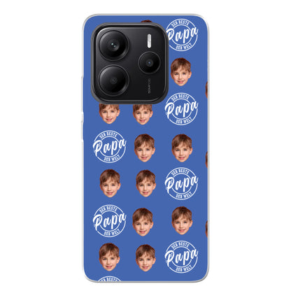 Xiaomi Redmi Note 14 5G source