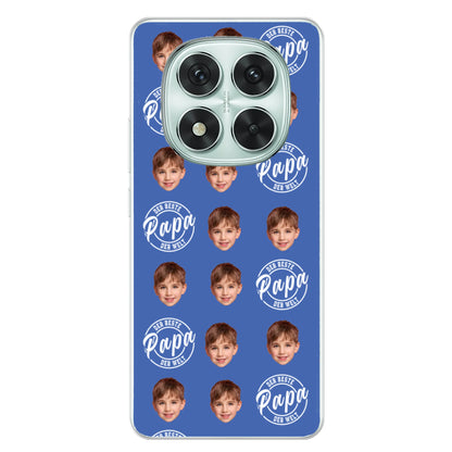 Xiaomi Redmi Note 14 Pro - Poco X7 source